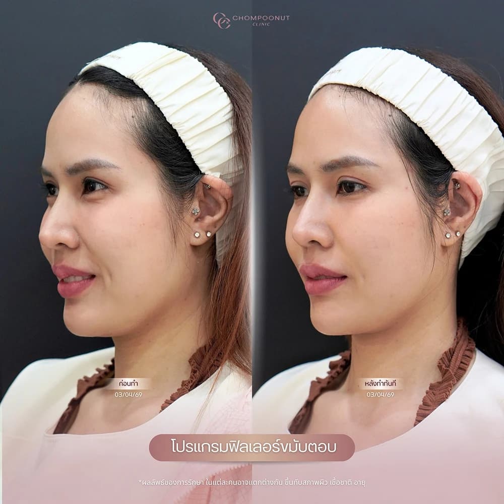 Review โปรแกรมฟิลเลอร์ 7